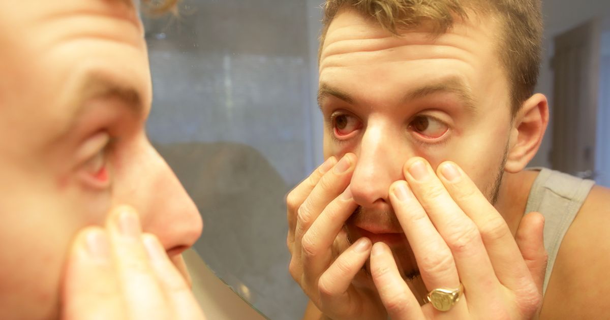 Optometrist urges people to look at corner of their eyes in morning for one colour - The Mirror